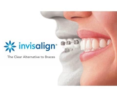 Affordable Invisalign Treatment Brisbane - Toombul Smiles Dental Clinic