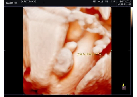 Save Huge with Combined Gender Scan and Live 4D/5D Realistic VueScan