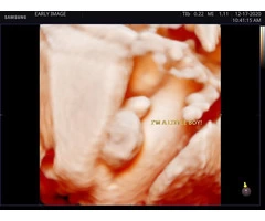 Save Huge with Combined Gender Scan and Live 4D/5D Realistic VueScan