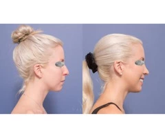 Plastic Surgeon Brisbane