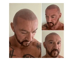 Scalp Micropigmentation Training Courses By Experts