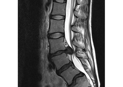 Get accurate diagnosis and treatment from a trusted back and spine specialist