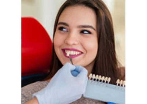 Get Affordable Porcelain Dental Veneers for a Better Smile - 3/3
