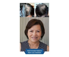 Consult an experienced trichologist for hair loss treatment in Adelaide