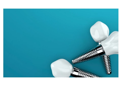 Get the Best Dental Implants Treatment From the Well-experienced Dentists - 2/3