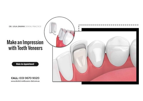 Get porcelain veneers treatment from an experienced dentist