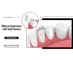 Get porcelain veneers treatment from an experienced dentist