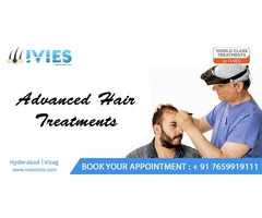 cost for hair transplant