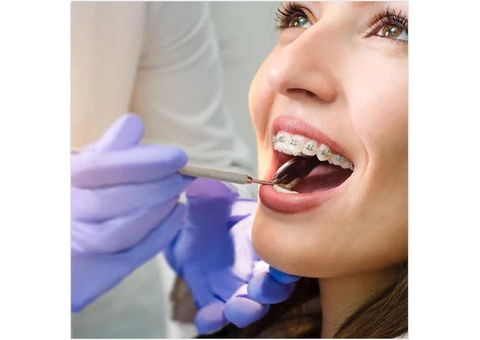 Get The Best Orthodontic Treatment Endeavour Hills