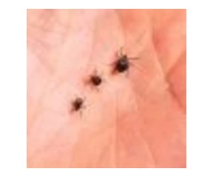 Do You Need Tick Control  Services At Your Property in North Shore?