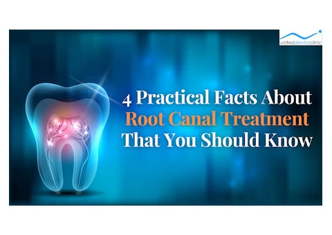 4 Practical Facts About Root Canal Treatment That You Should Know