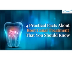 4 Practical Facts About Root Canal Treatment That You Should Know