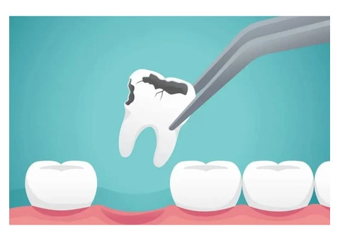 Feeling Pain in Tooth – Get a Tooth Consultant