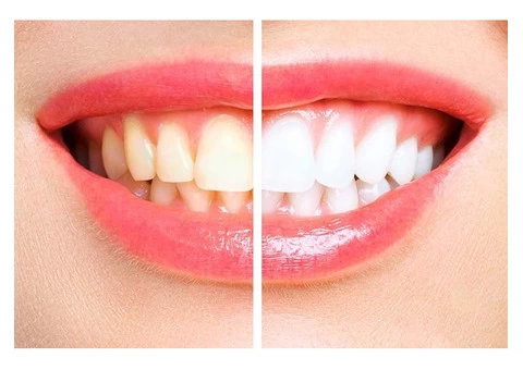 Dentists in Annerley - 5/7