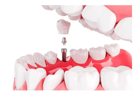 Dentists in Annerley - 6/7