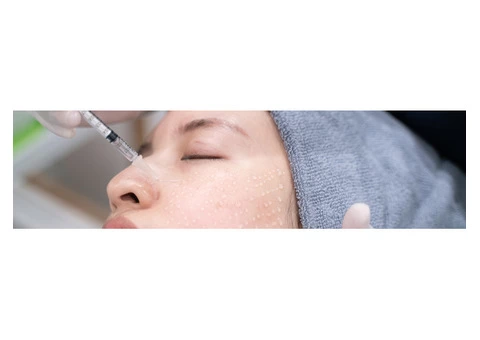Micro Needling Melbourne