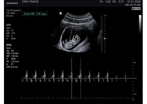 Instant Reassurance Scan - 24*7 Available