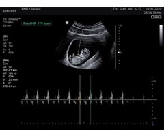 Instant Reassurance Scan - 24*7 Available