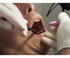 Get Professional Level Treatments From Orthodontists