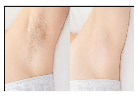 IPL Underarm Hair Removal Melbourne