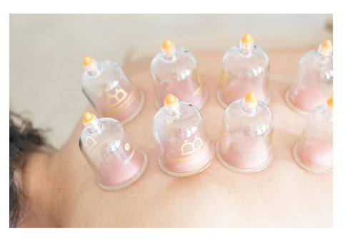 Cupping Massage Therapy