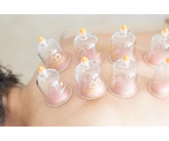 Cupping Massage Therapy