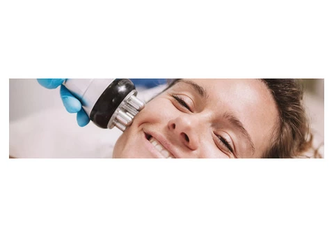 Radio Frequency Face Lift