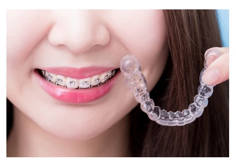 Invisalign Cost Sydney CBD