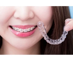 Invisalign Cost Sydney CBD