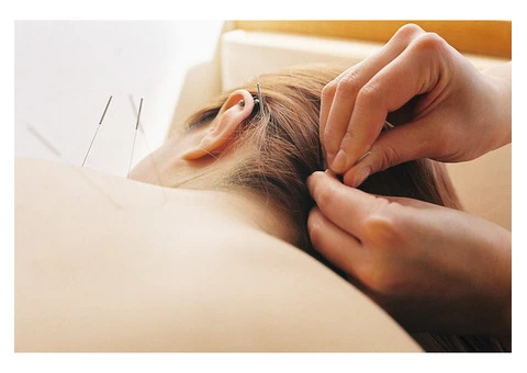 Acupuncturist Perth - Tao Acupuncture Clinic - 1/5