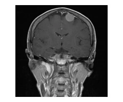 Your most reliable option for Melbourne neurosurgery