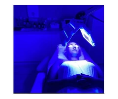 Blue Light Acne Treatment