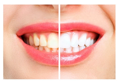 Malvern East Dentist - 2/3