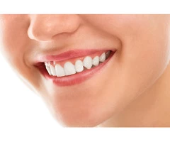 Get a beautiful smile with teeth whitening in Melbourne
