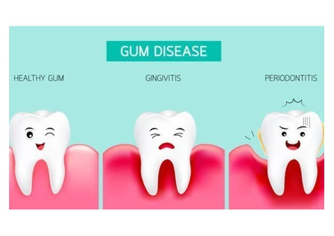 Gingivitis Treatment in Everton Hills