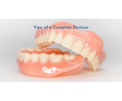 Partial Dentures - My Gentle Dentist Arana Hills North Brisbane