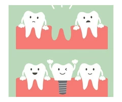 Dental Implants Cost Australia | My Gentle Dentist