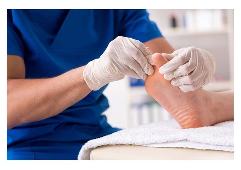 Wart Removal Melbourne