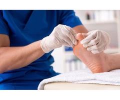 Wart Removal Melbourne