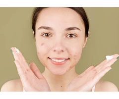 Achieve Healthy Skin with the Best Skin Care Experts in Australia!
