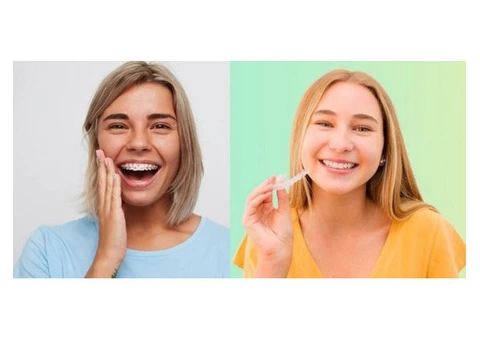 Clear Aligners Gold Coast