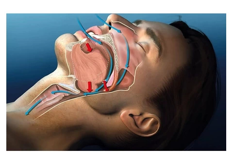Sleep Apnea Test At Home Near Me Across Australia
