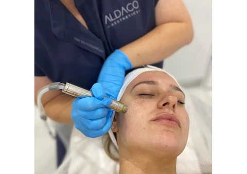 Hydro dermabrasion