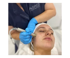 Hydro dermabrasion