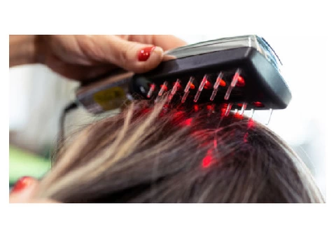 Top Information on The Benefits of Laser Hair Treatments for Thinning Hair from dBest Australia!