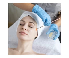 Synergie Chemical Peels