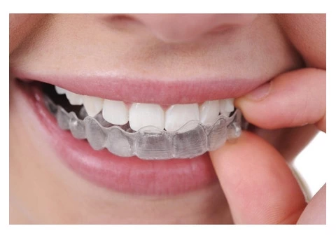Clear Invisalign Aligner to Straighten Your Teeth Aesthetically