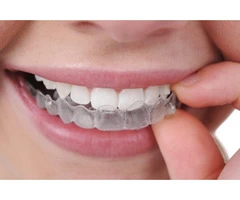 Clear Invisalign Aligner to Straighten Your Teeth Aesthetically