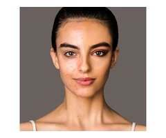 Treat Pigmentation at cosmetic clinic Melbourne