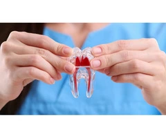 Save your damaged tooth with root canal treatment at United Dental Clinic!